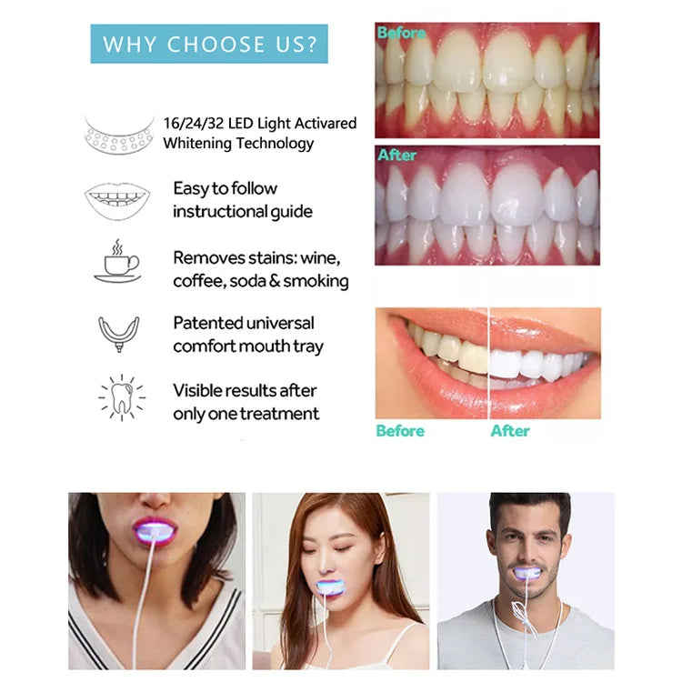 Effective At-Home LED Wireless Teeth Whitening Kit