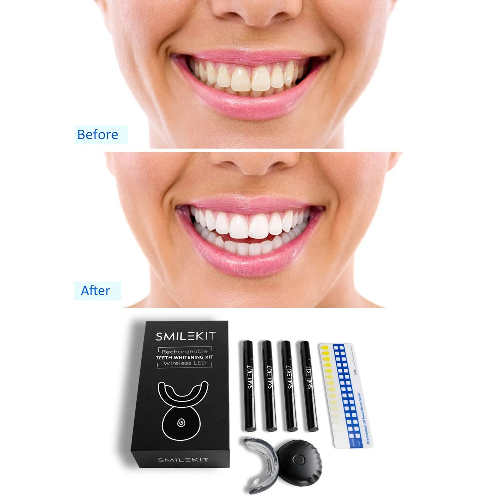 Effective At-Home LED Wireless Teeth Whitening Kit