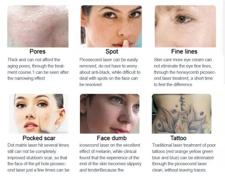 2025 Professional 2 in 1 Laser Hair Removal Machine Picosecond Q Switch ND YAG 1064NM Tattoo Removal 3 Waves Device