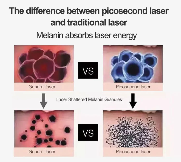 2025 Professional 2 in 1 Laser Hair Removal Machine Picosecond Q Switch ND YAG 1064NM Tattoo Removal 3 Waves Device