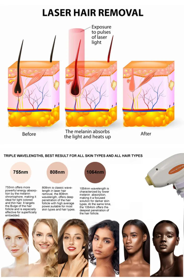 2025 Professional 2 in 1 Laser Hair Removal Machine Picosecond Q Switch ND YAG 1064NM Tattoo Removal 3 Waves Device