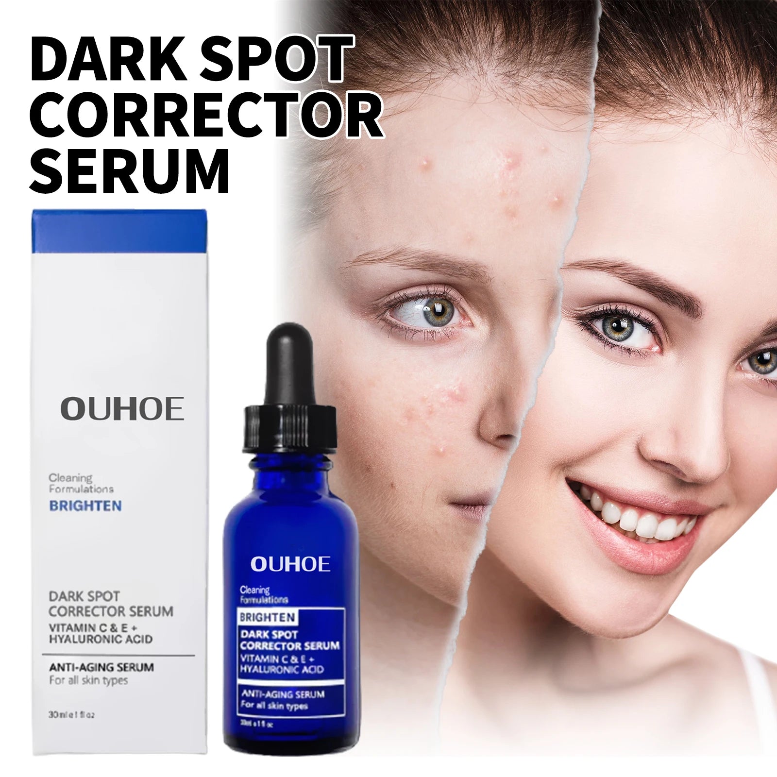 OUHOE Dark Spot Repair Essence, Repair Acne Pimple Lightening Spot Fine Lines Moisturizing Firming Whitening Essence - Daisan Mart