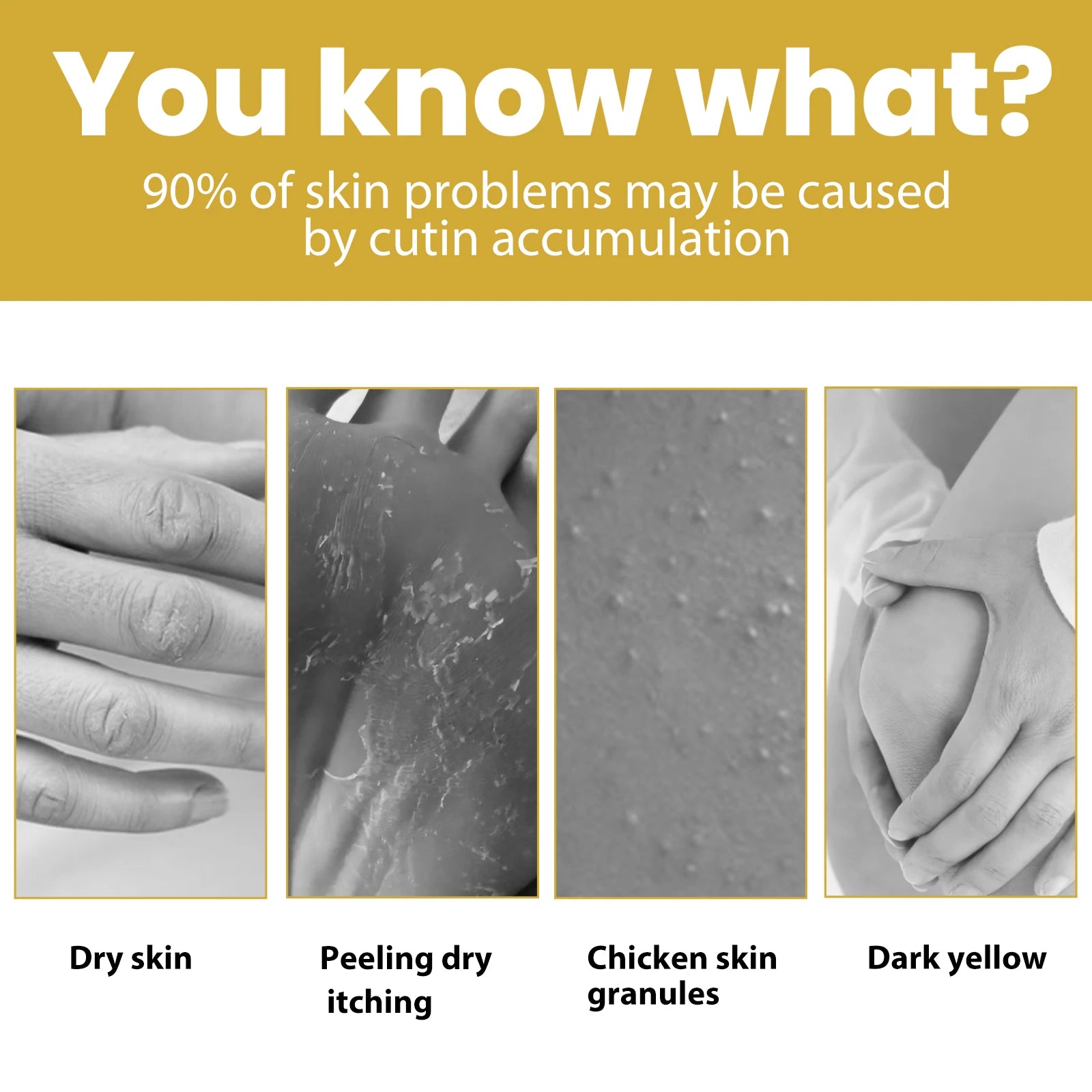 EELHOE Body Exfoliating Oil Skin Tone Brightening Body Skin Dead Skin Moisturizing Whitening Skin Care Oil