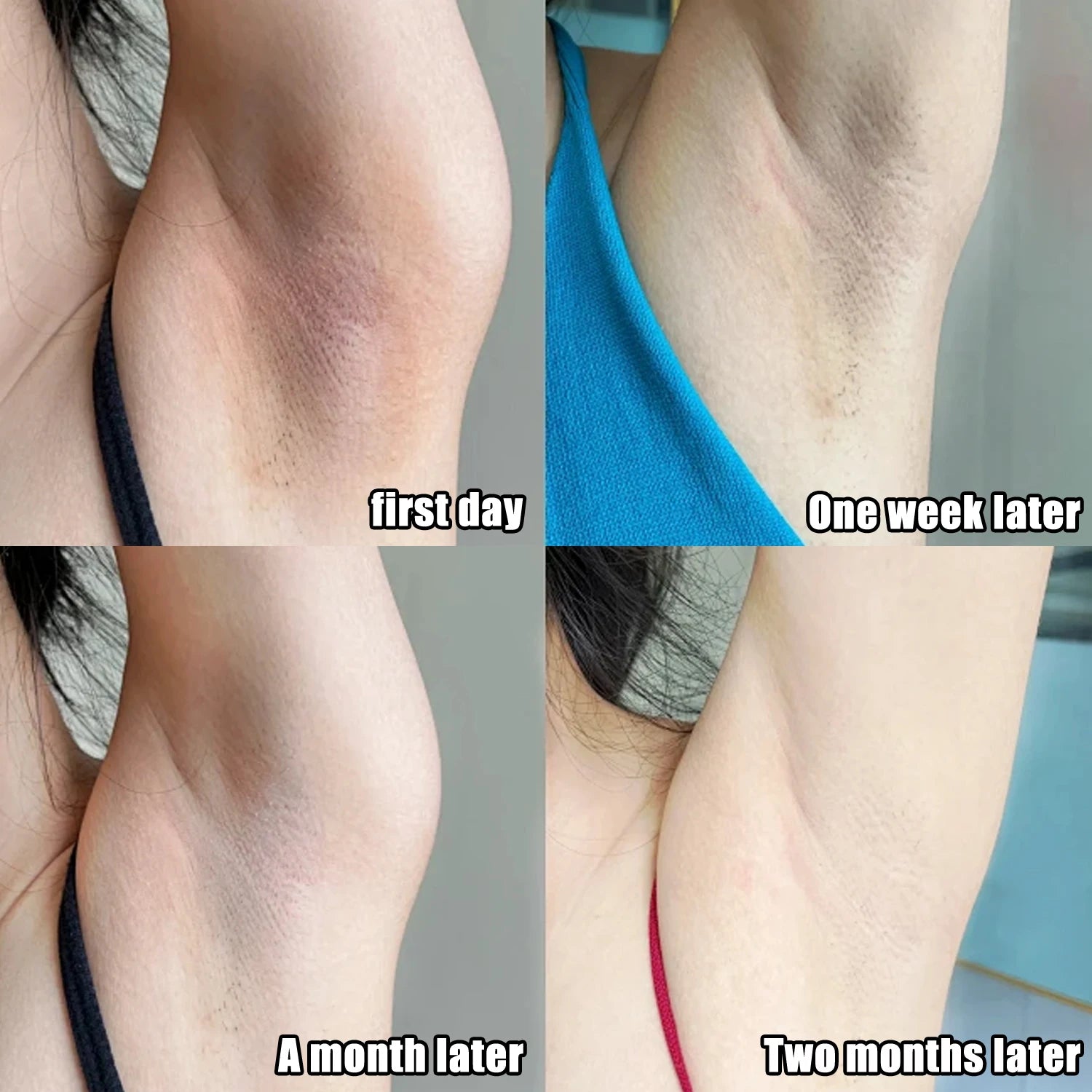 Whitening Moisturizing Cream for Intimate Areas &amp; Body for Women