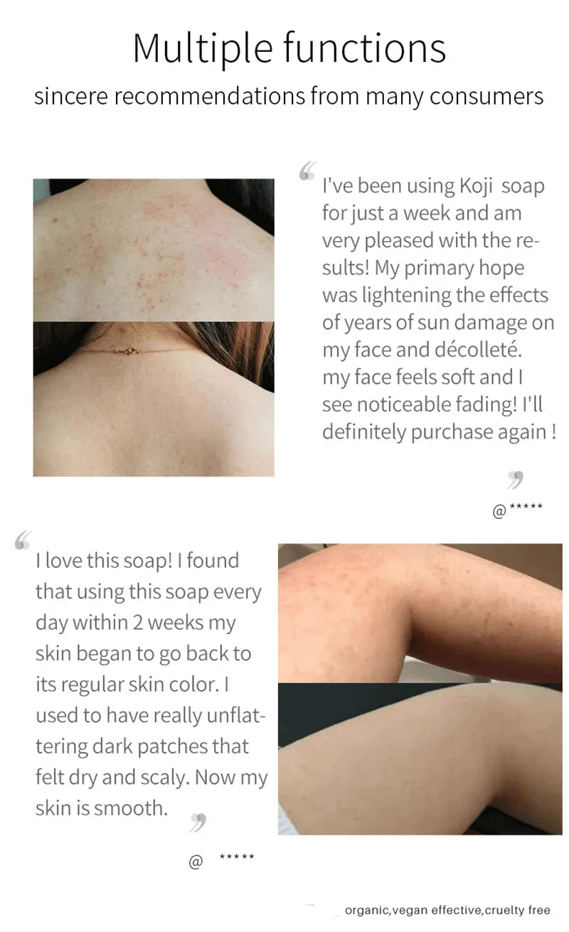 Sea Salt Body Acne Removal Soap Treatment Face Butt Back Acne Marks Smooth Repair Chicken Skin Moisturizing Whitening Skin Care