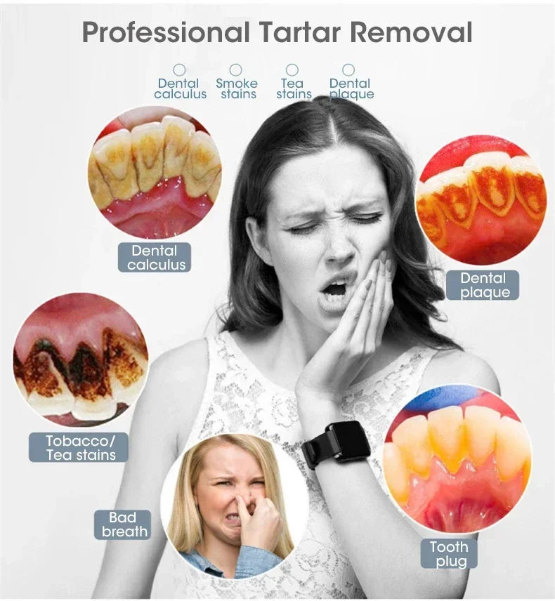 Bàn Chải Điện 3in1 Làm Sạch & Trắng Răng USB Sạc