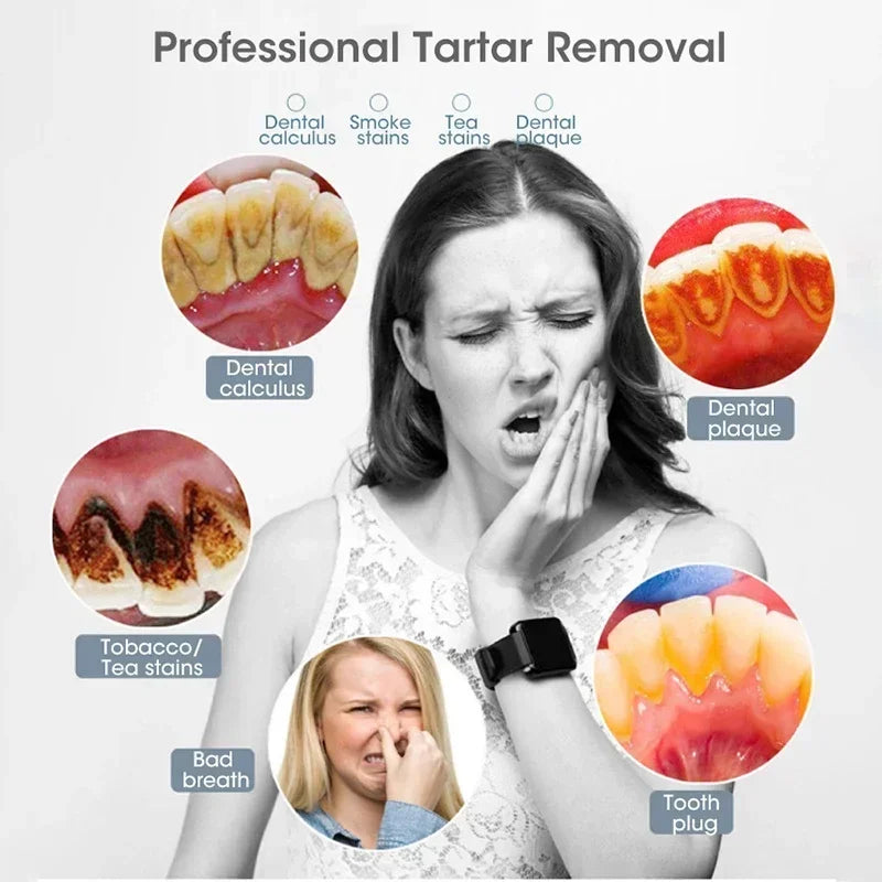 Bàn Chải Điện 3in1 Làm Sạch & Trắng Răng USB Sạc