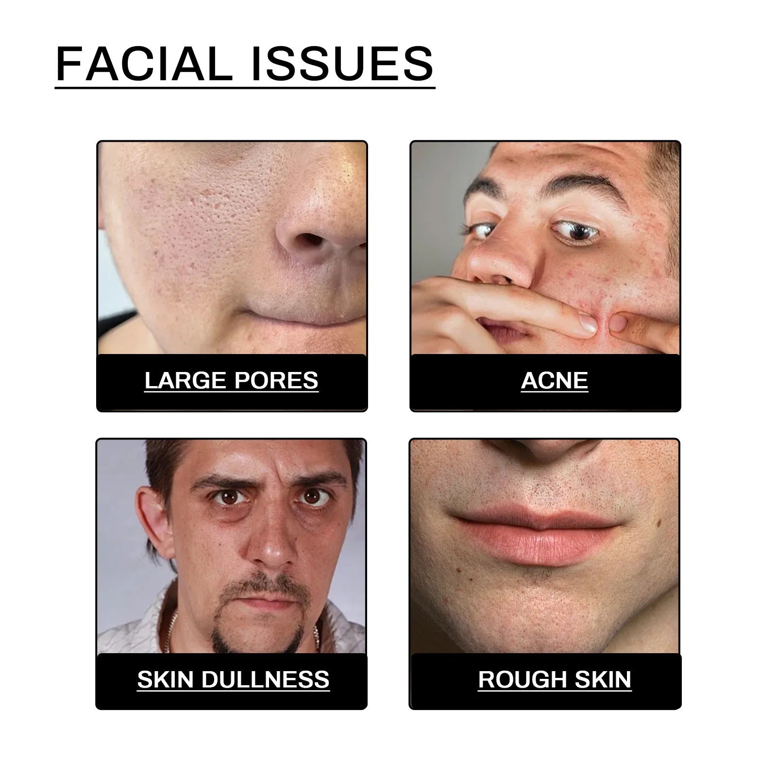 Sữa rửa mặt nam ngừa mụn, kiểm soát dầu và tẩy tế bào chết