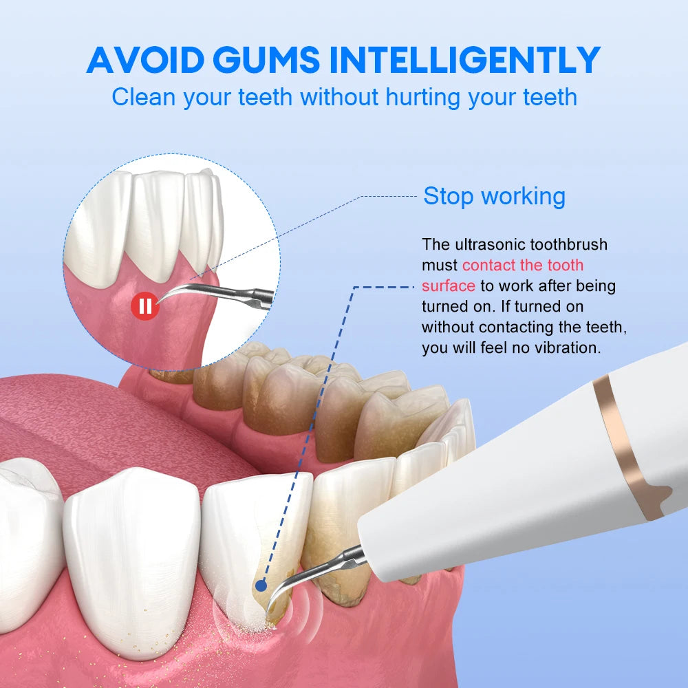 Máy Tẩy Vôi Răng Cầm Tay Siêu Âm Làm Sạch Răng
