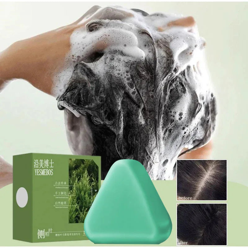 Platycladus Herbal Shampoo for Natural Hair Loss Prevention