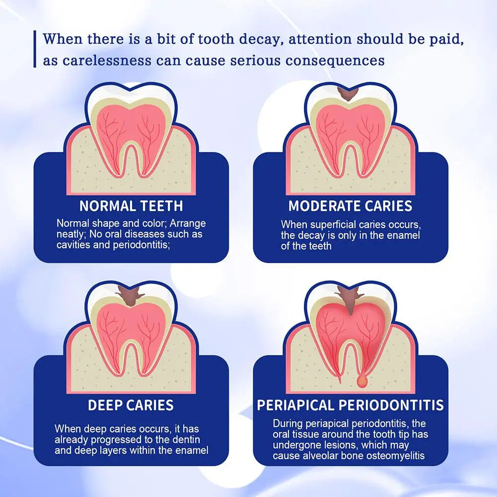 Anti Decay Toothpaste Dental Caries Repair Cream Prevent Tooth Decay Protect TeethDeep Clean Whitening & Fresh Breath Toothpast - Daisan Mart