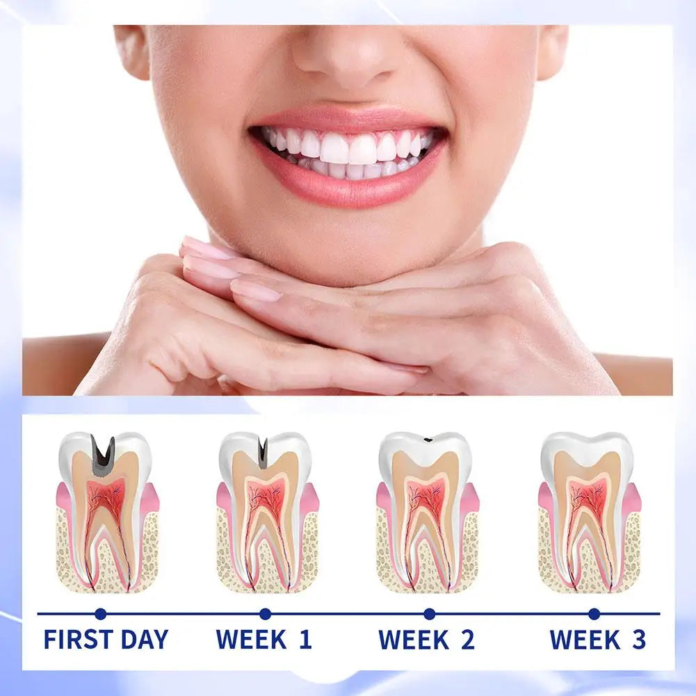 Anti Decay Toothpaste Dental Caries Repair Cream Prevent Tooth Decay Protect TeethDeep Clean Whitening & Fresh Breath Toothpast - Daisan Mart