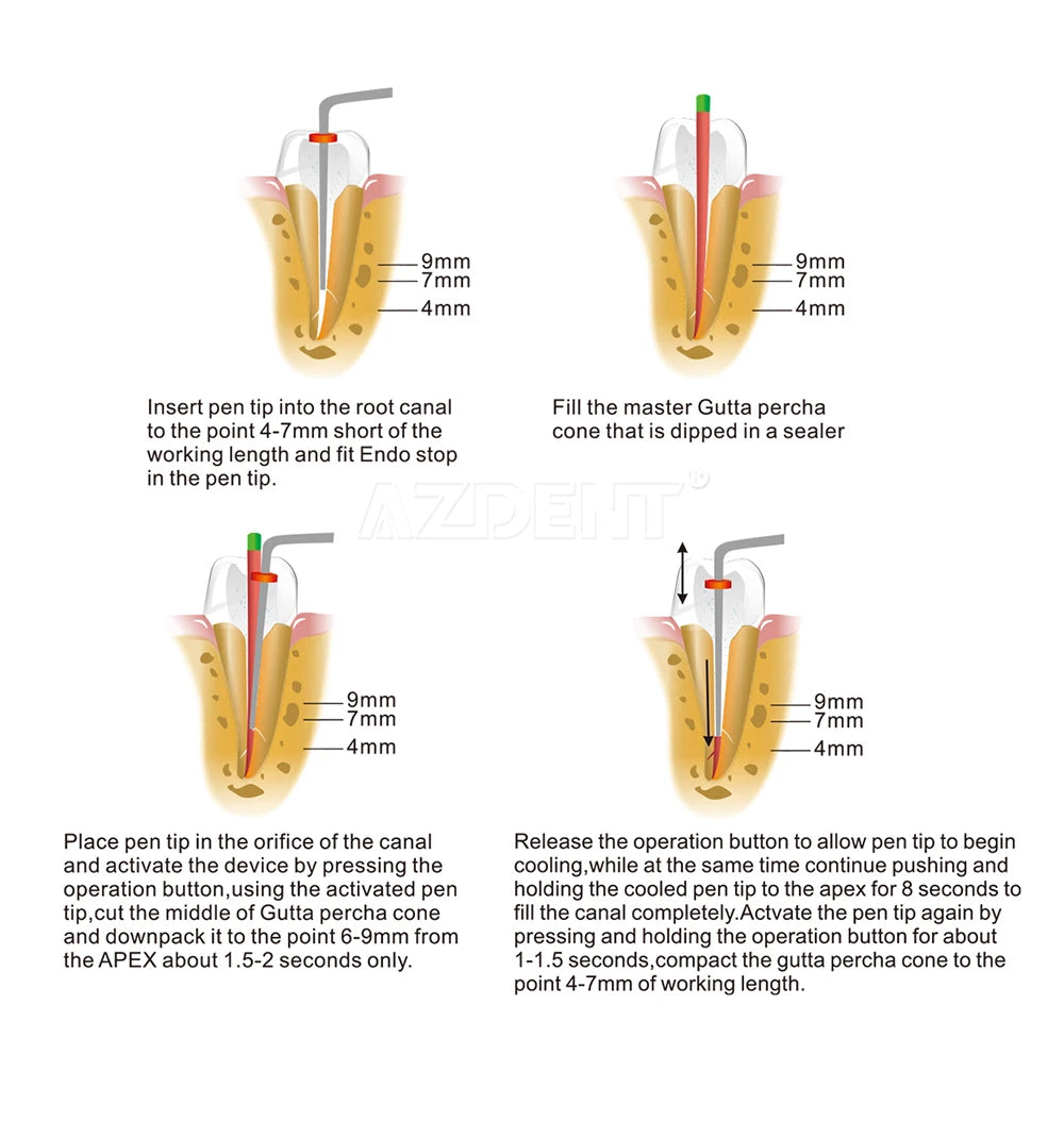 AZDENT Bút Trám Nóng Nhanh 3s - Dụng Cụ Nội Nha