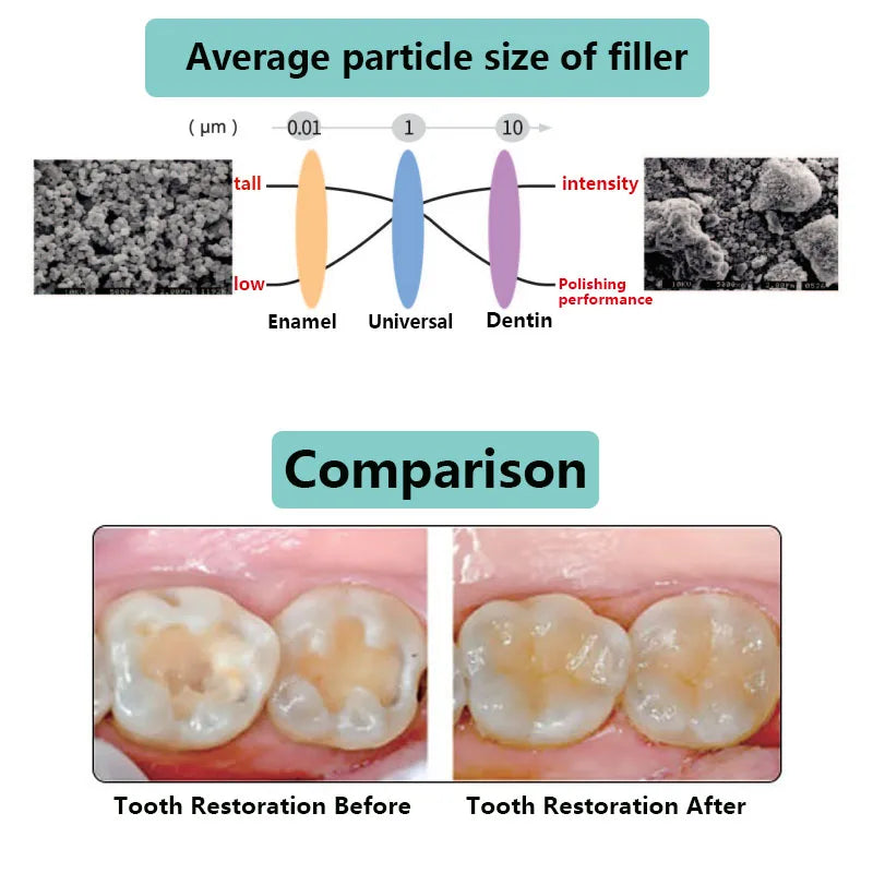 Resin Trám Răng Nano Hậu Cầu - Dentin Light Cure