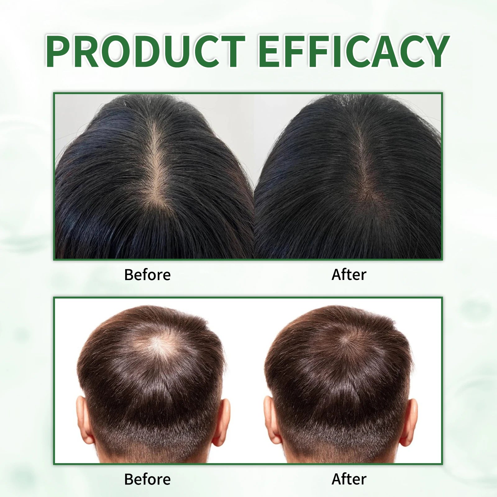 Dầu Gội Batana 100ML Phục Hồi & Dưỡng Tóc Tự Nhiên