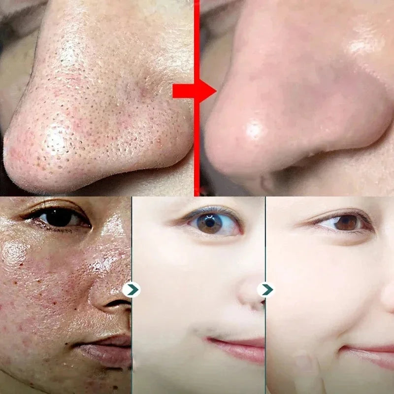 Green Tea Mask for Blackheads &amp; Pore Tightening