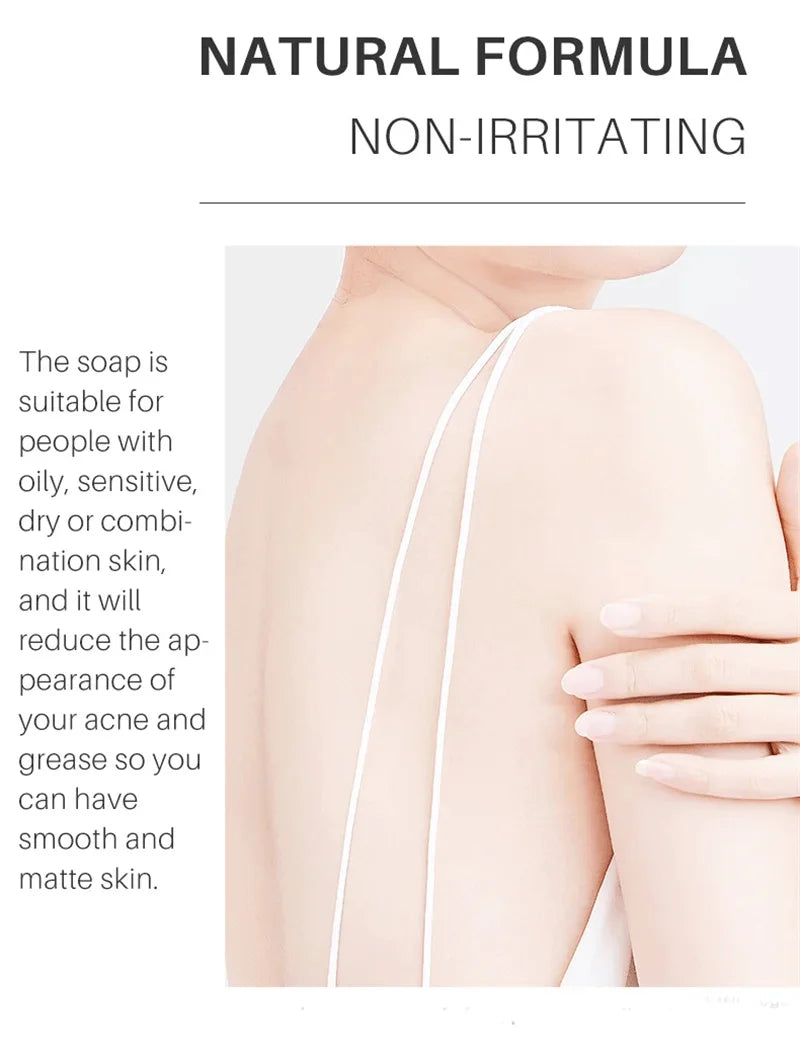 Sea Salt Body Acne Removal Soap Treatment Face Butt Back Acne Marks Smooth Repair Chicken Skin Moisturizing Whitening Skin Care