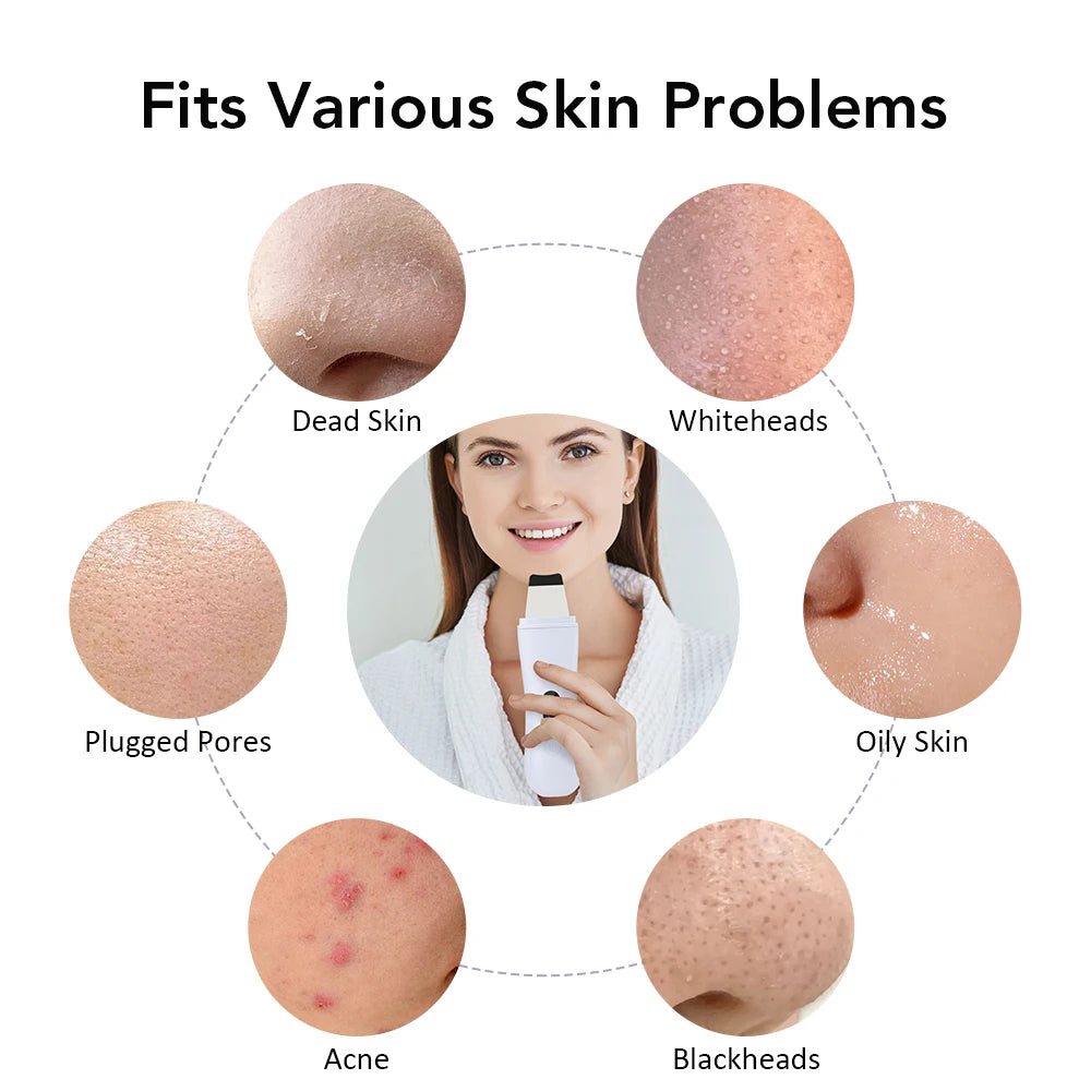 Ultrasonic Facial Cleanser Exfoliates &amp; Deep Cleanses