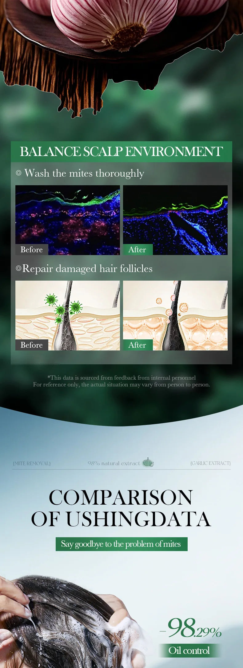 SADOER shampoo soothes itching, removes dandruff, and controls oil