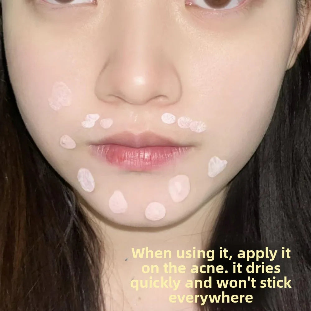 Serum Hồng 10ml - Se Khít Lỗ Chân Lông & Mờ Thâm Mụn