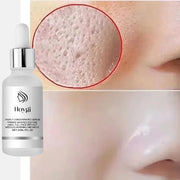 Serum Se Khít Lỗ Chân Lông, Săn Da, Mịn Màng Hàn Quốc