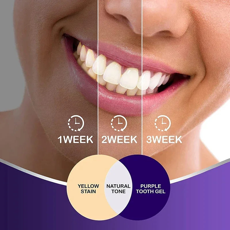 30ml V34 SmileKit Purple Toothpaste Removes Tartar Clean Oral Hygiene Fresh Breath Whitening Teeth Care Products - Daisan Mart