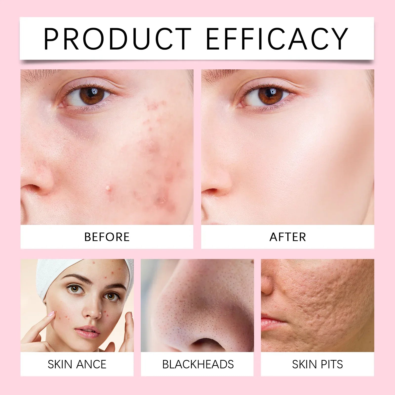 Oil Control &amp; Pore Minimizing Facial Cleanser - Deeply Moisturize, Anti-Acne &amp; Blackhead Removal, Exfoliating Face Wash