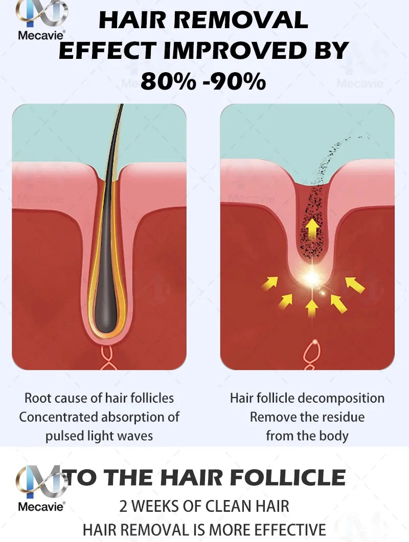 New 808nm Diode Laser Hair Removal Machine 4Wavelength Permanent Painless Physical Underarm Body Care Depilation Equipment