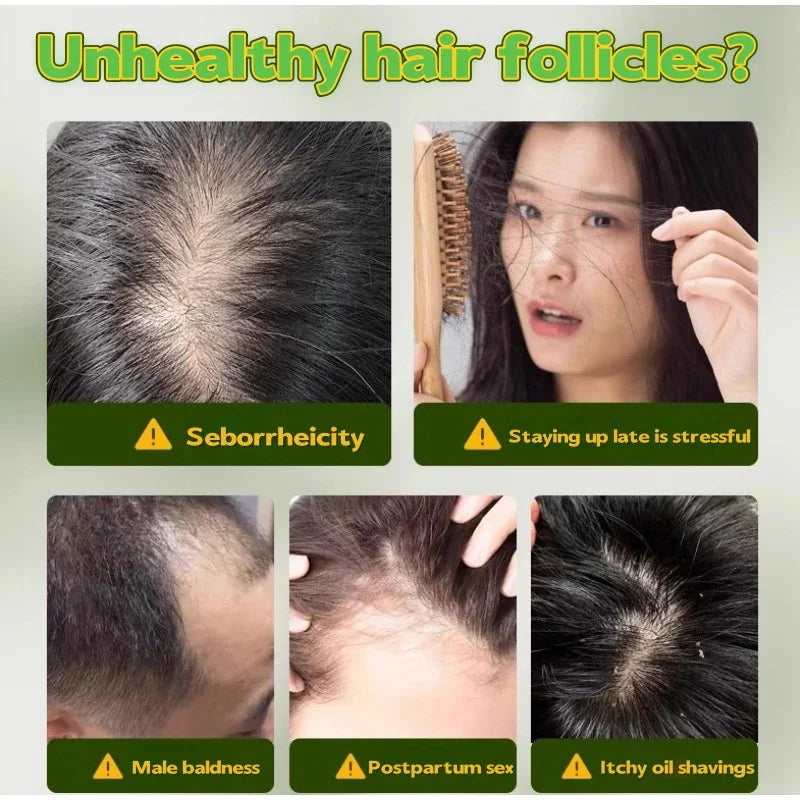 Platycladus Herbal Shampoo for Natural Hair Loss Prevention