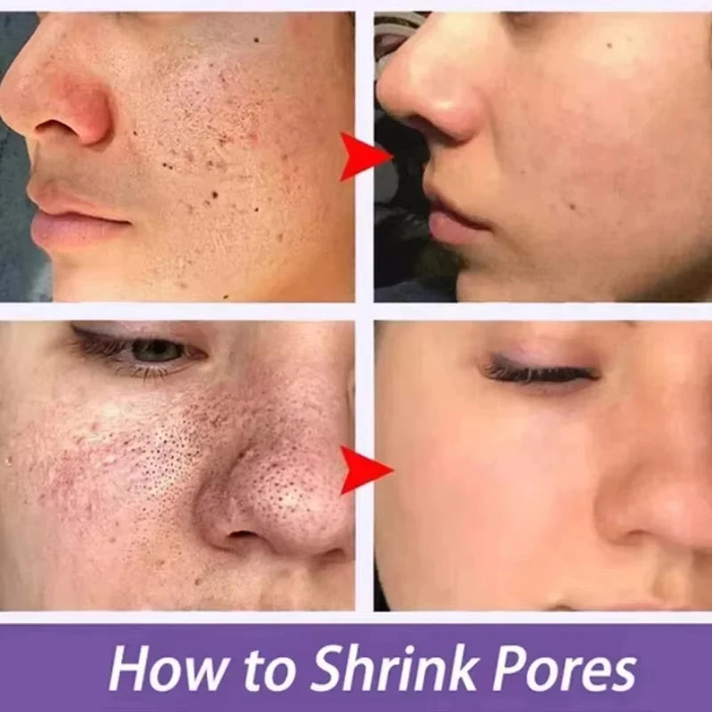 Serum Thu Nhỏ Lỗ Chân Lông Hàn Quốc Lactic Acid