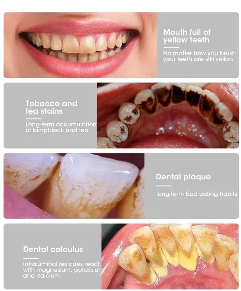 Bàn Chải Điện 3in1 Làm Sạch & Trắng Răng USB Sạc