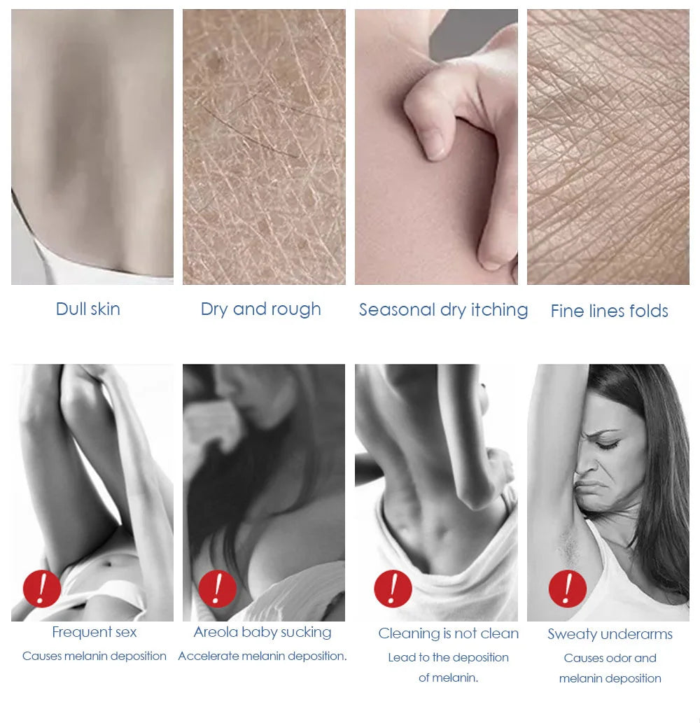 Whitening Cream for Private Areas, Armpits, Knees, Elbows