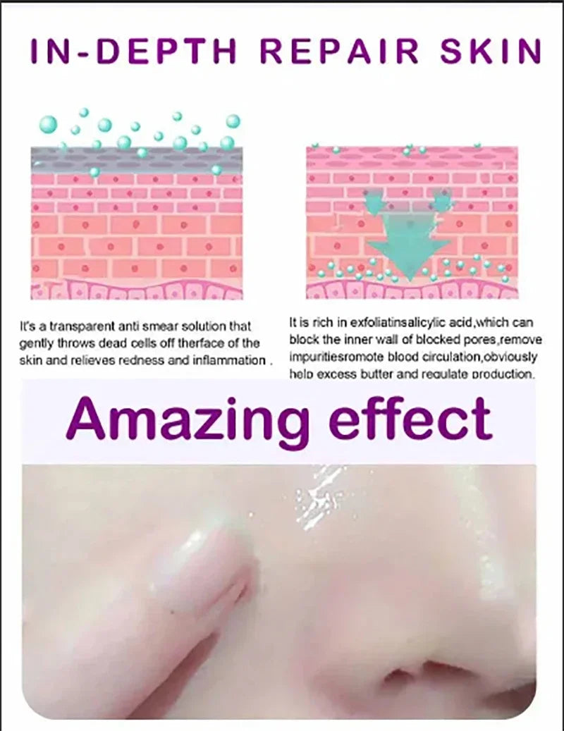 Skin Texture | Pore ​​Refining Resurfacing, Brightening Facial Serum with Retinol and Niacinamide Non-Comedogenic