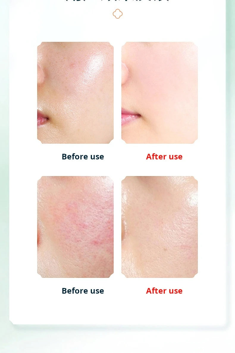 Multi-function Deep Cleansing Warm Vibrating Facial Cleanser