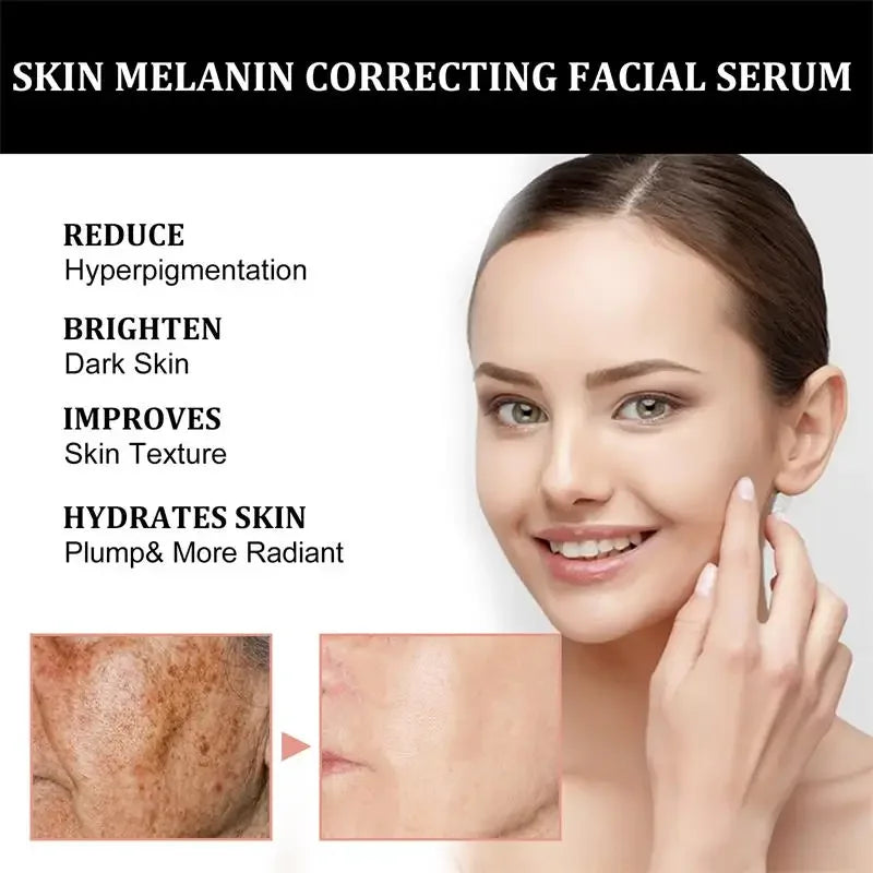 Melanin Facial Repair Serum 30ml Hydrating Repairing Dark Skin Whiten Vitamin C Essence Reduces Pigmentation Improve Skin Makeup