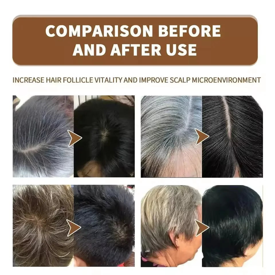 Serum for Natural Black Hair Restoration &amp; Hair Loss Prevention