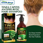 Anti-Dandruff Shampoo, Moisturizing &amp; Scalp Restoration