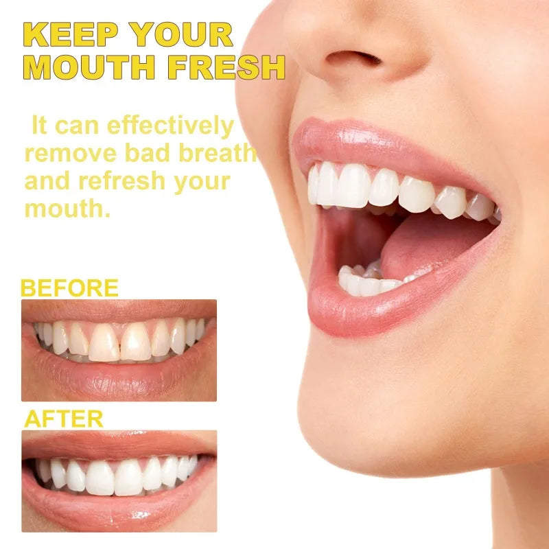 Nước Súc Miệng Propolis Smile Trắng Răng Sạch Mảng Bám - Daisan Mart