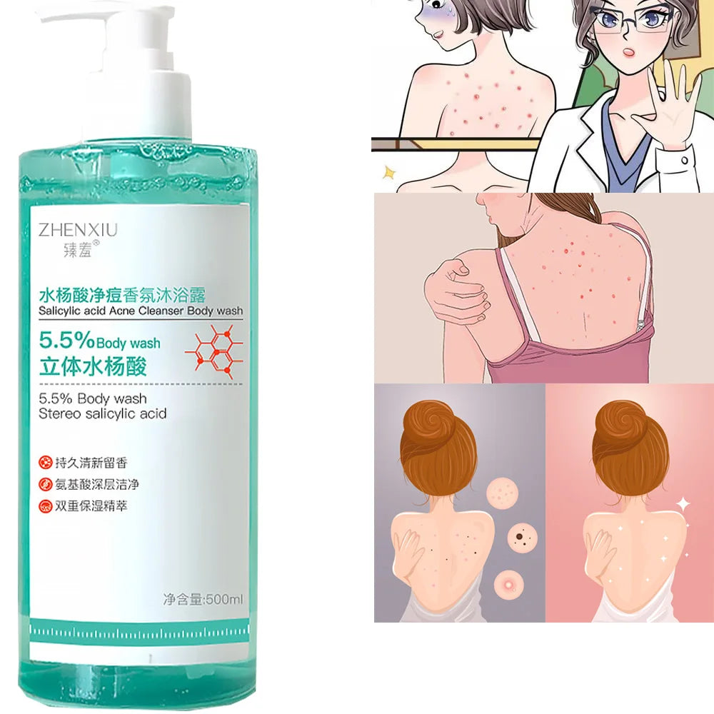 Acne Treatment Body Wash 16.9 oz Gentle &amp; Smoothing