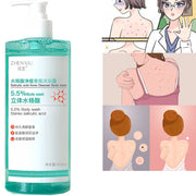 Acne Treatment Body Wash 16.9 oz Gentle &amp; Smoothing