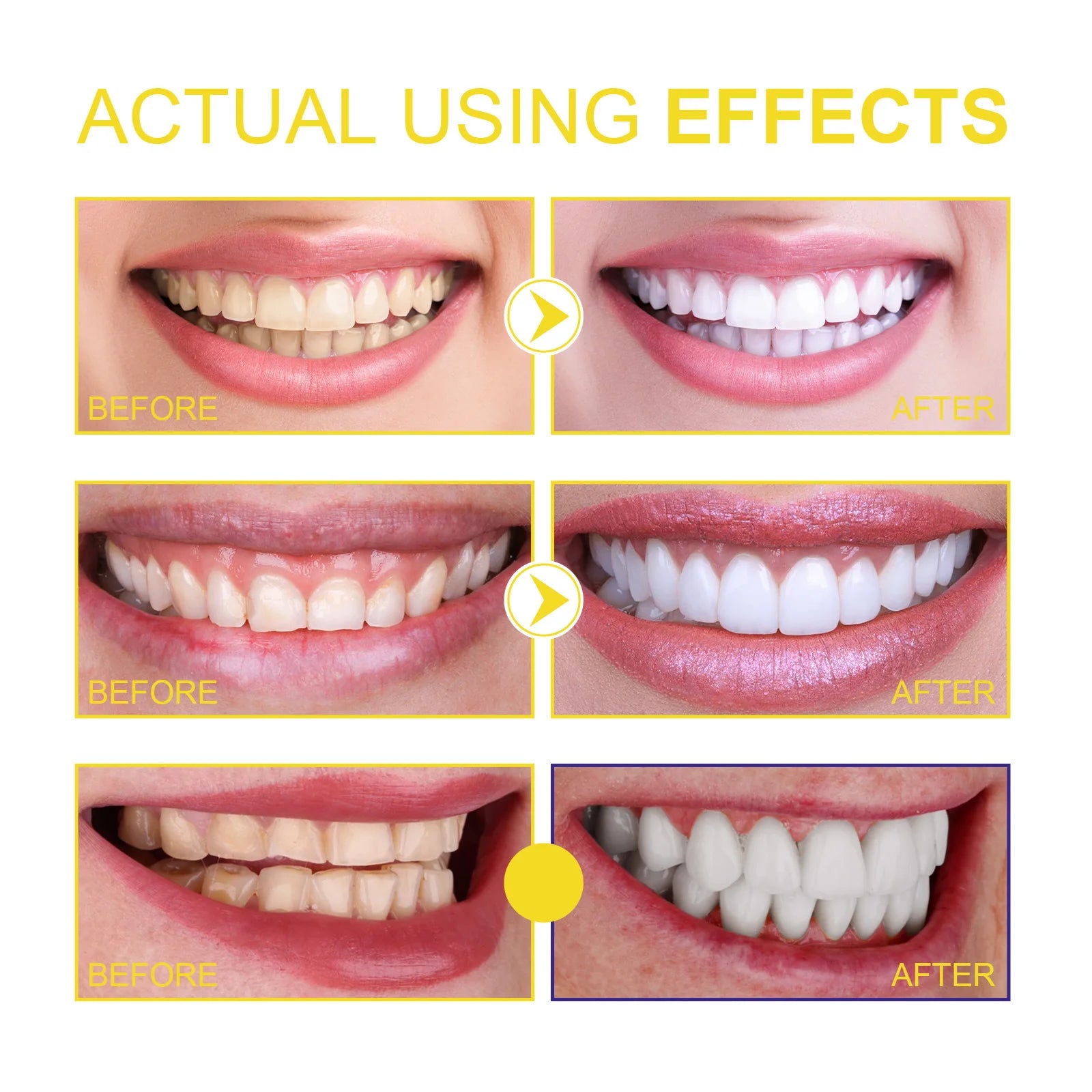 Nước Súc Miệng Propolis Smile Trắng Răng Sạch Mảng Bám - Daisan Mart