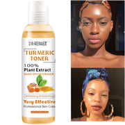 Turmeric Toner to Remove Dark Spots &amp; Acne 118ml for Dark Skin