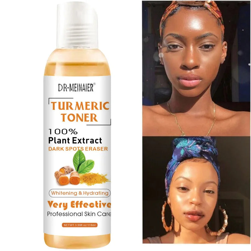 Turmeric Toner to Remove Dark Spots &amp; Acne 118ml for Dark Skin