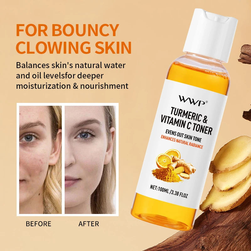 Turmeric Vitamin C Toner-Turmeric Antioxidant Refreshing &amp; Moisturizing,Brightens &amp; Softens Face Care Toner for All Skin Types