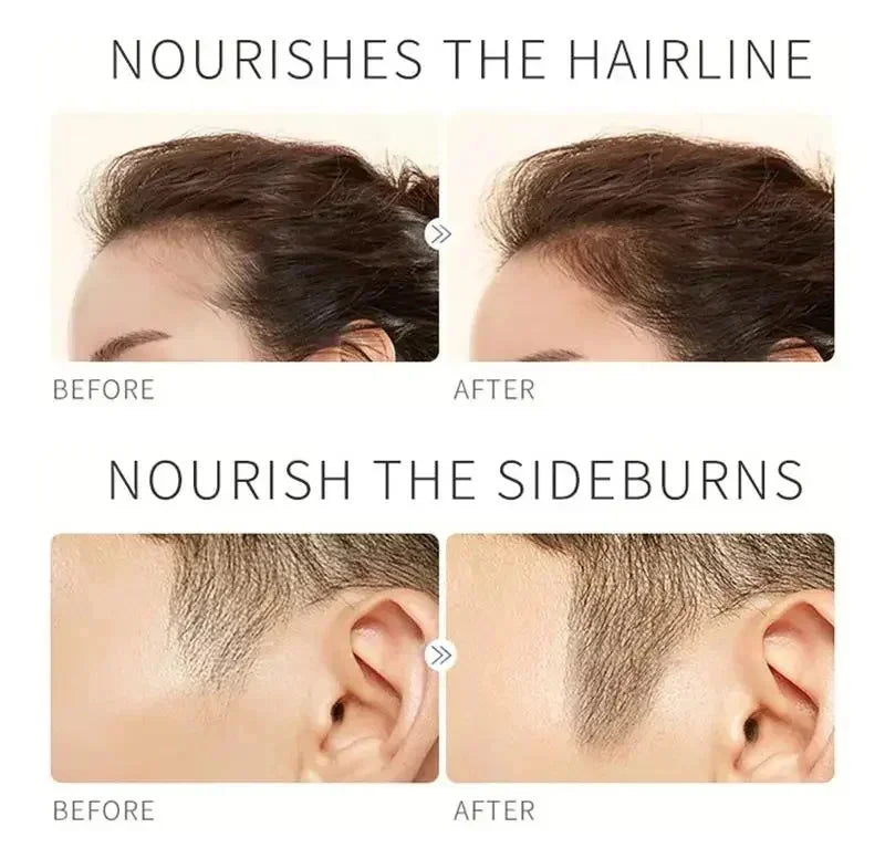 Serum Mọc Lông Mày & Mi Nhanh Dày Chống Rụng