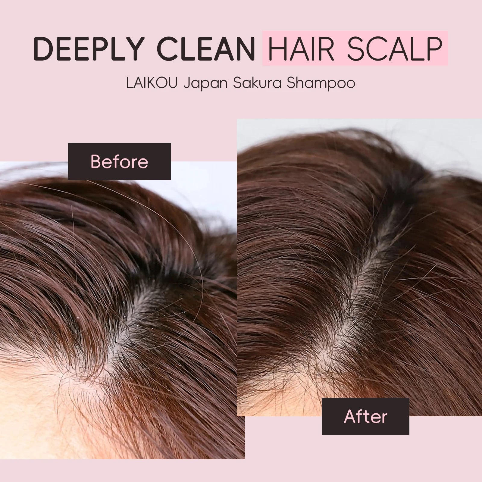 LAIKOU Dầu Gội Hoa Anh Đào Nhật - Phục Hồi & Mượt Tóc