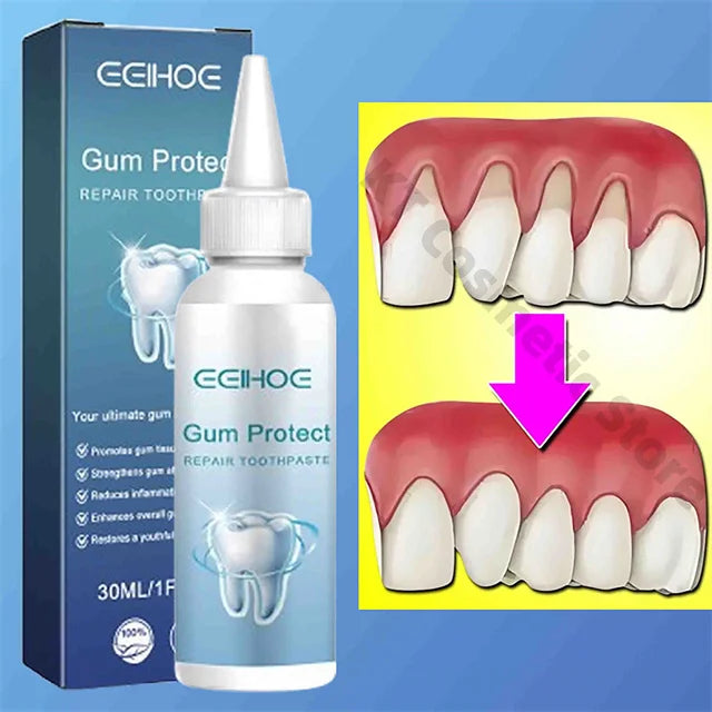 Rapid Repairing Gum Atrophy Toothpaste Effectively Relieve Dental Allergies Deep Cleaning Tooth Caries Damaged Teeth Care Serum
