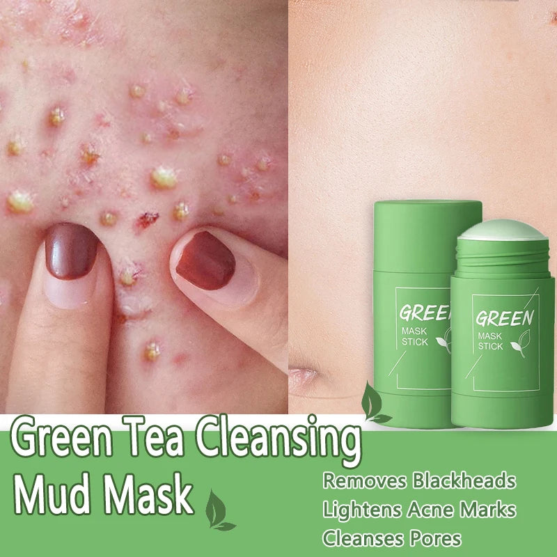 Green Tea Mask for Blackheads &amp; Pore Tightening