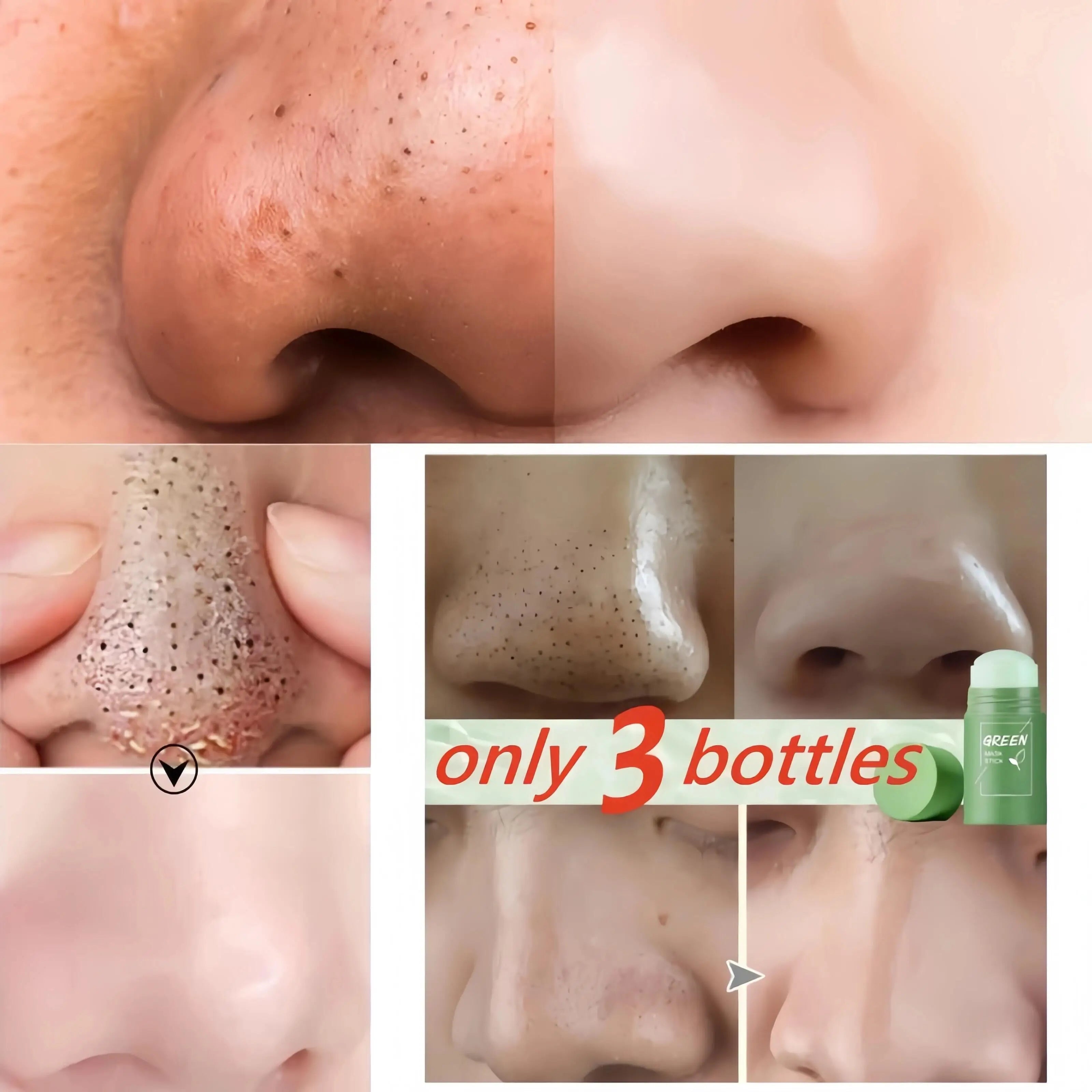 Green Tea Mask for Blackheads &amp; Pore Tightening