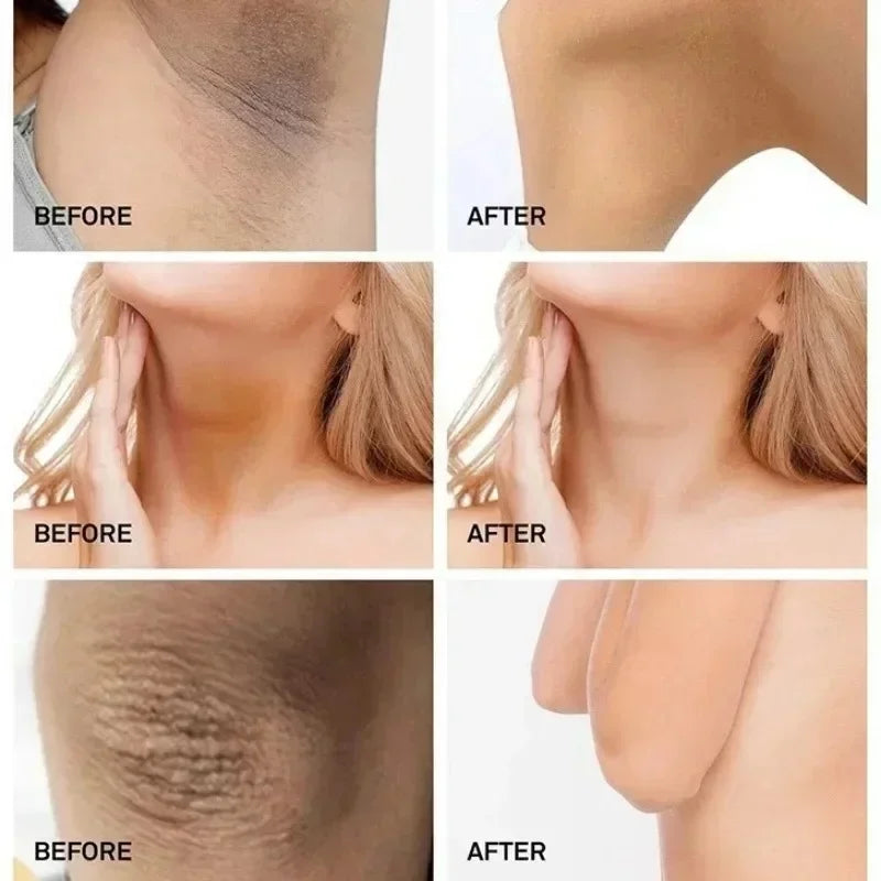 Whitening Moisturizing Cream for Intimate Areas &amp; Body for Women